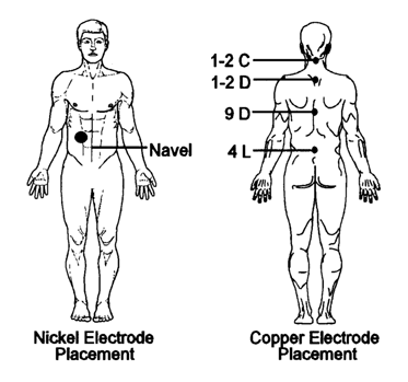 wet cell battery attachment to centers